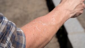 Essential Body Care Routine for Dry Skin: Hydrated, Happy Skin Starts Here