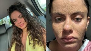 Tia Zakher's "Caveman" Skincare Routine Went Viral